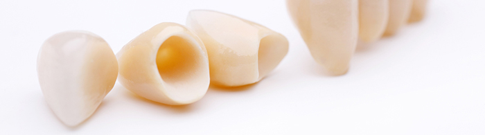 Coroas dentárias ou restaurações para dentes quebrados