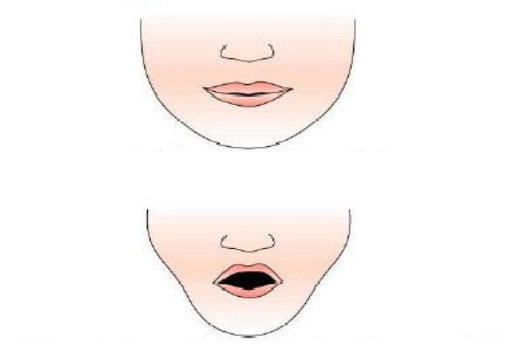 A chupeta pode alterar a estrutura dos ossos do rosto